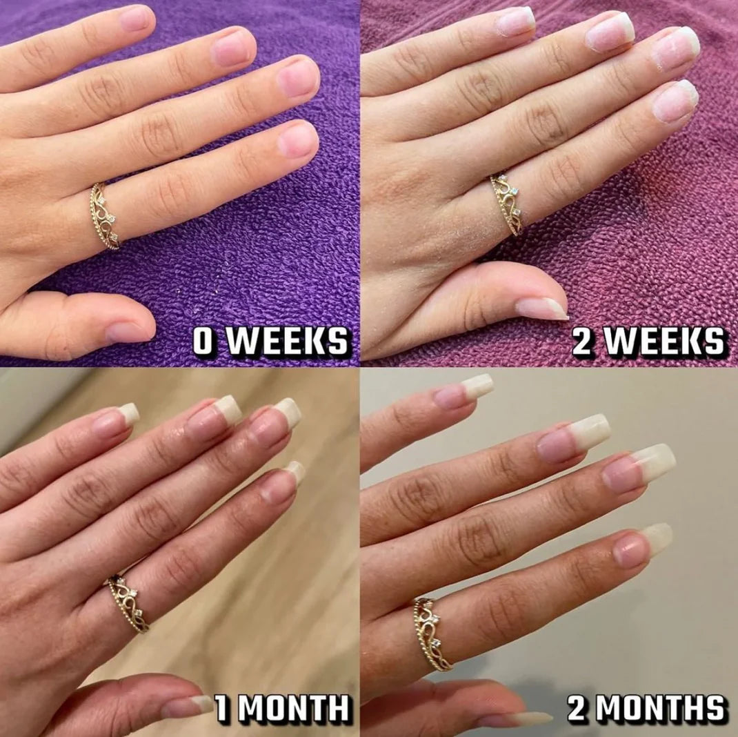 Rejuvenation Natural Nail Growth Oil BOGO