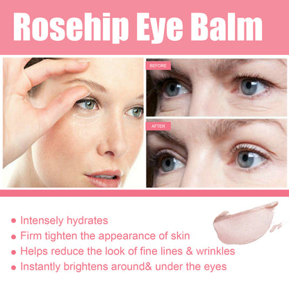 Natural Rosehip Eye Balm