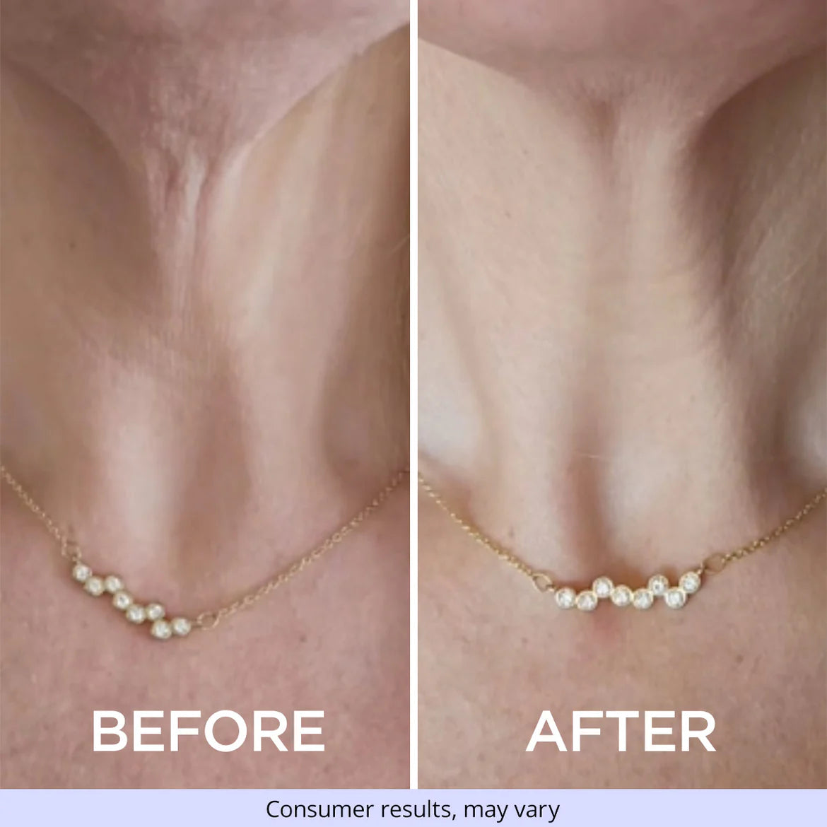 Tighten and Lift Neck Cream