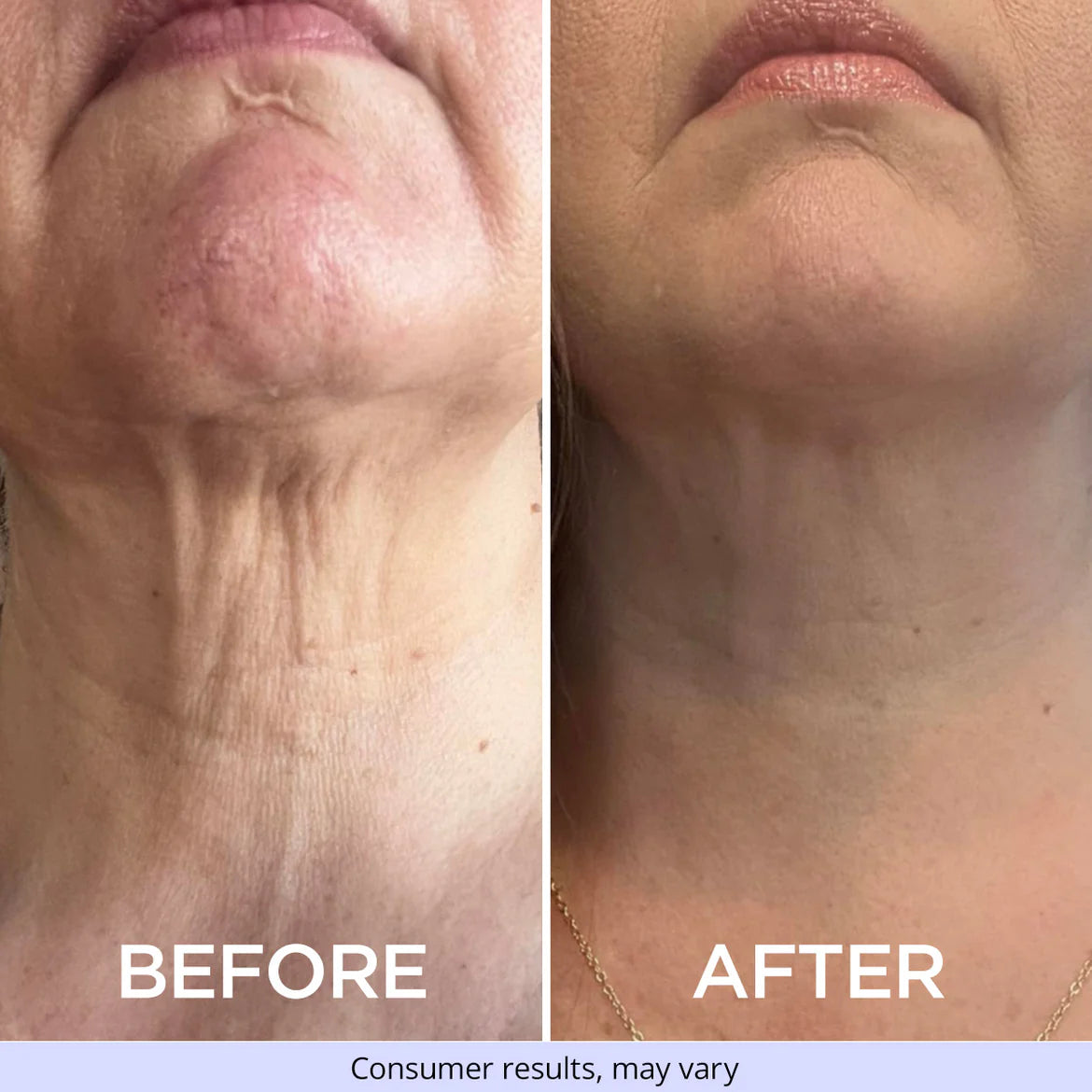 Tighten and Lift Neck Cream