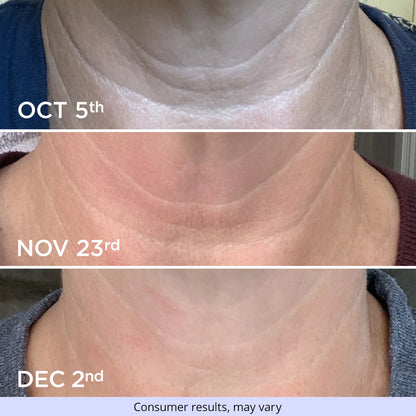 Tighten and Lift Neck Cream